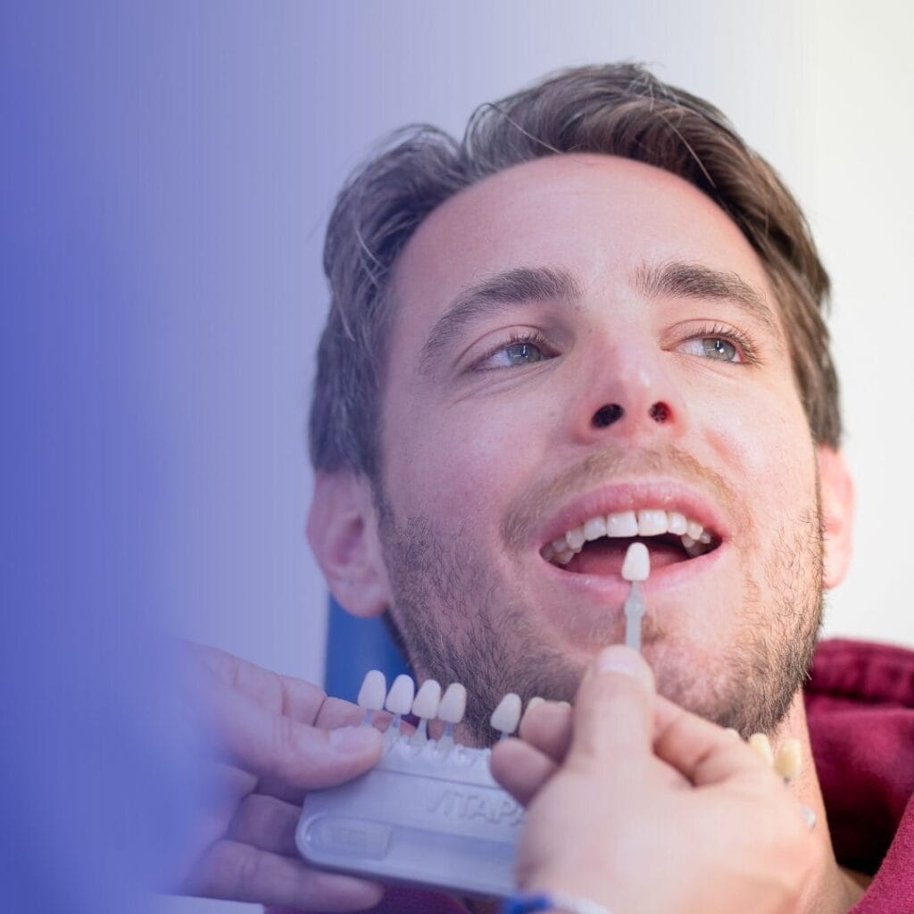 Faccette Dentali 1 faccette dentali a legnano