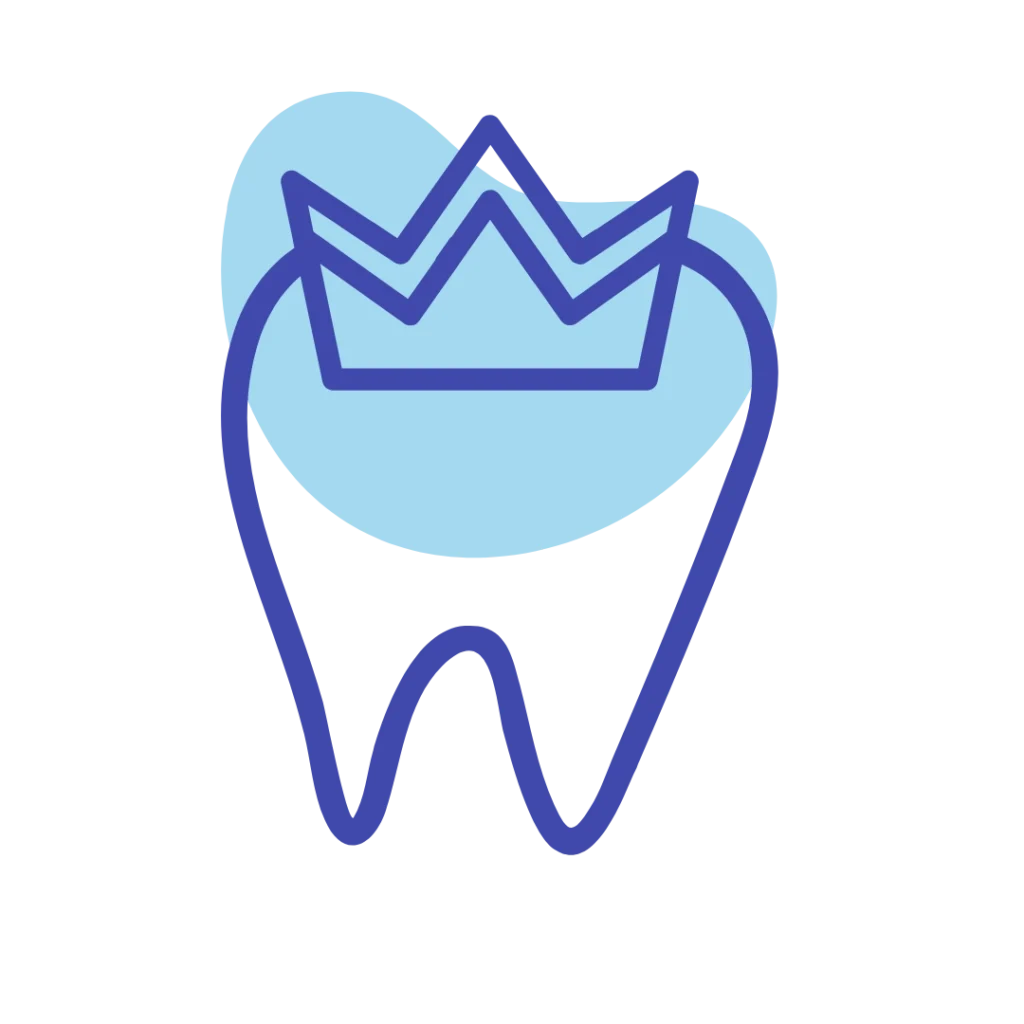 Faccette dentali